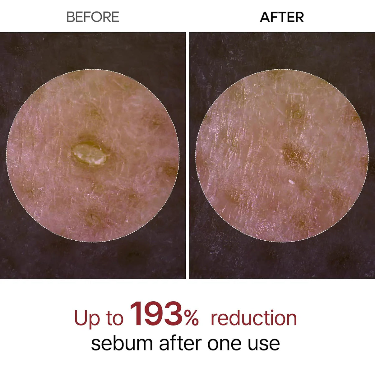 Elaria Rice Peel Serum Ampoule™