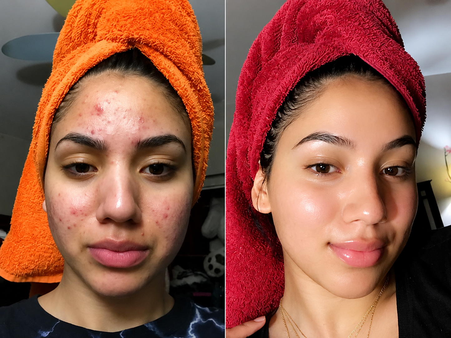 Elaria Rice Peel Serum Ampoule™