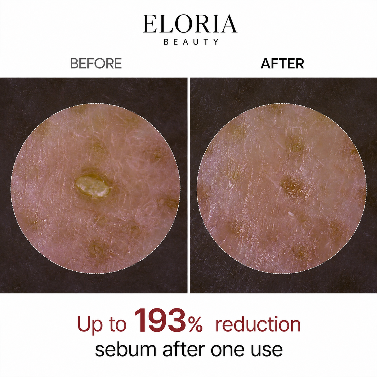 Elaria Rice Peel Serum Ampoule™