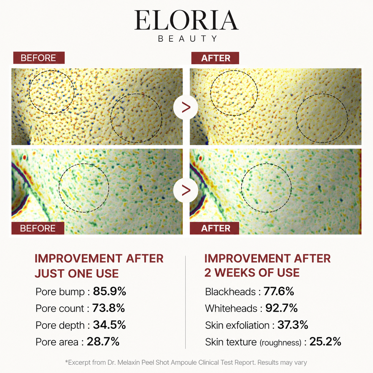 Elaria Rice Peel Serum Ampoule™