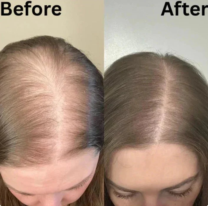 Champú orgánico de romero para el crecimiento del cabello