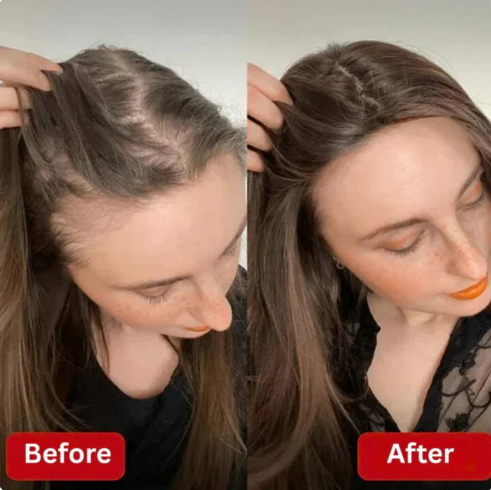 Before and After